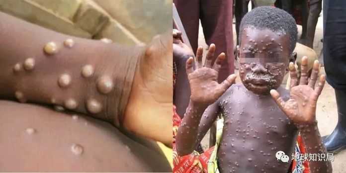 5581b14a114e4eae6da1af4788535845dff1df2f ,後續圖片可能造成嚴重不適