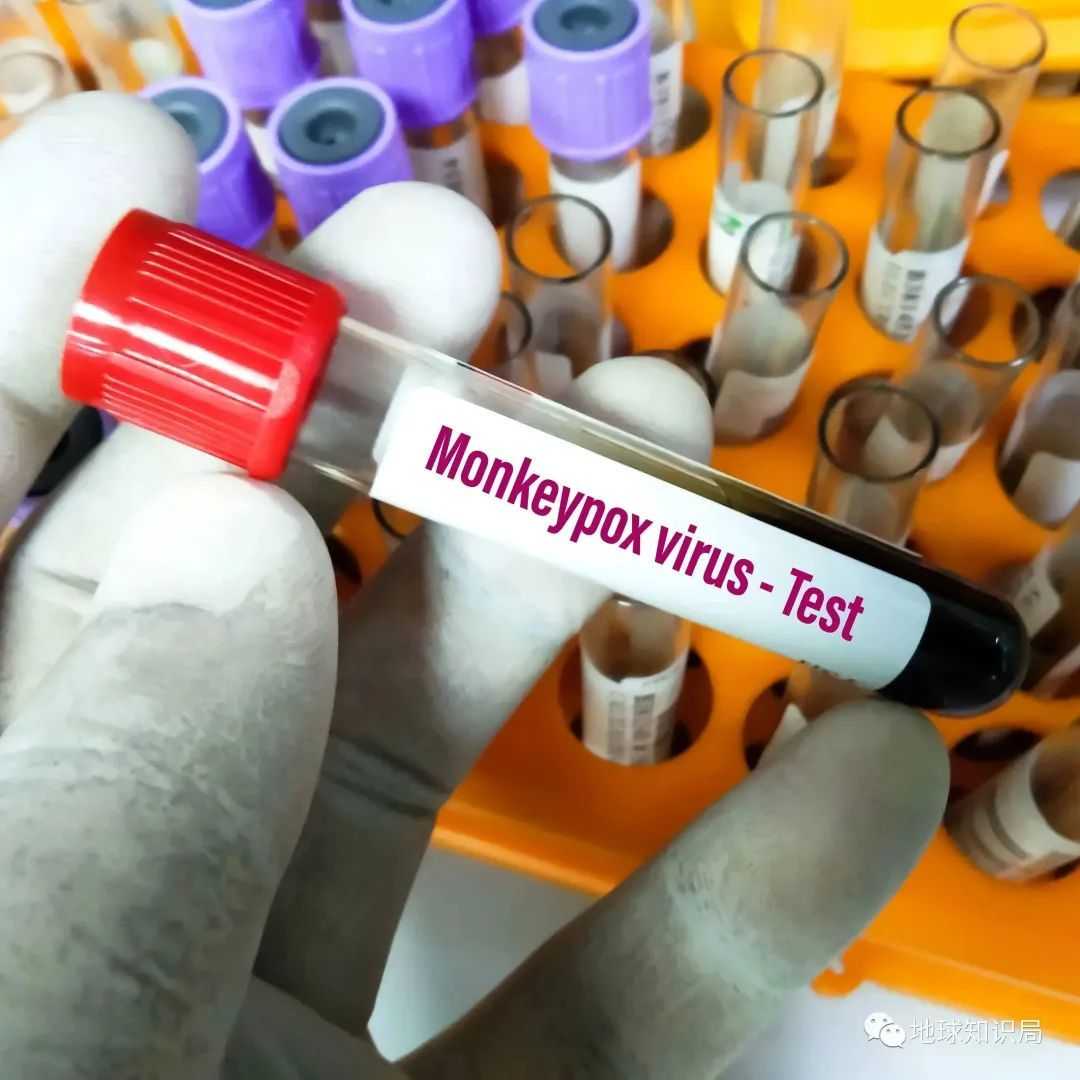 8a1dfcf5de2bb43050d73b47c85bcb0d49ed82a2 (圖:shutterstock)