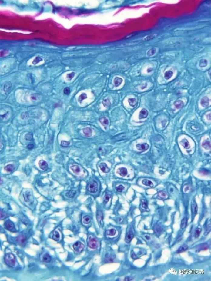 e8e18a4e8eeef5a2562e2682c4d9b11964700324 從感染猴痘的猴子身上採集的皮膚切片(圖:CDC)